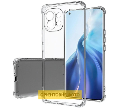 TPU чохол GETMAN Ease logo посилені кути Full Camera для Xiaomi Redmi 15 (Global) Безбарвний (прозорий)